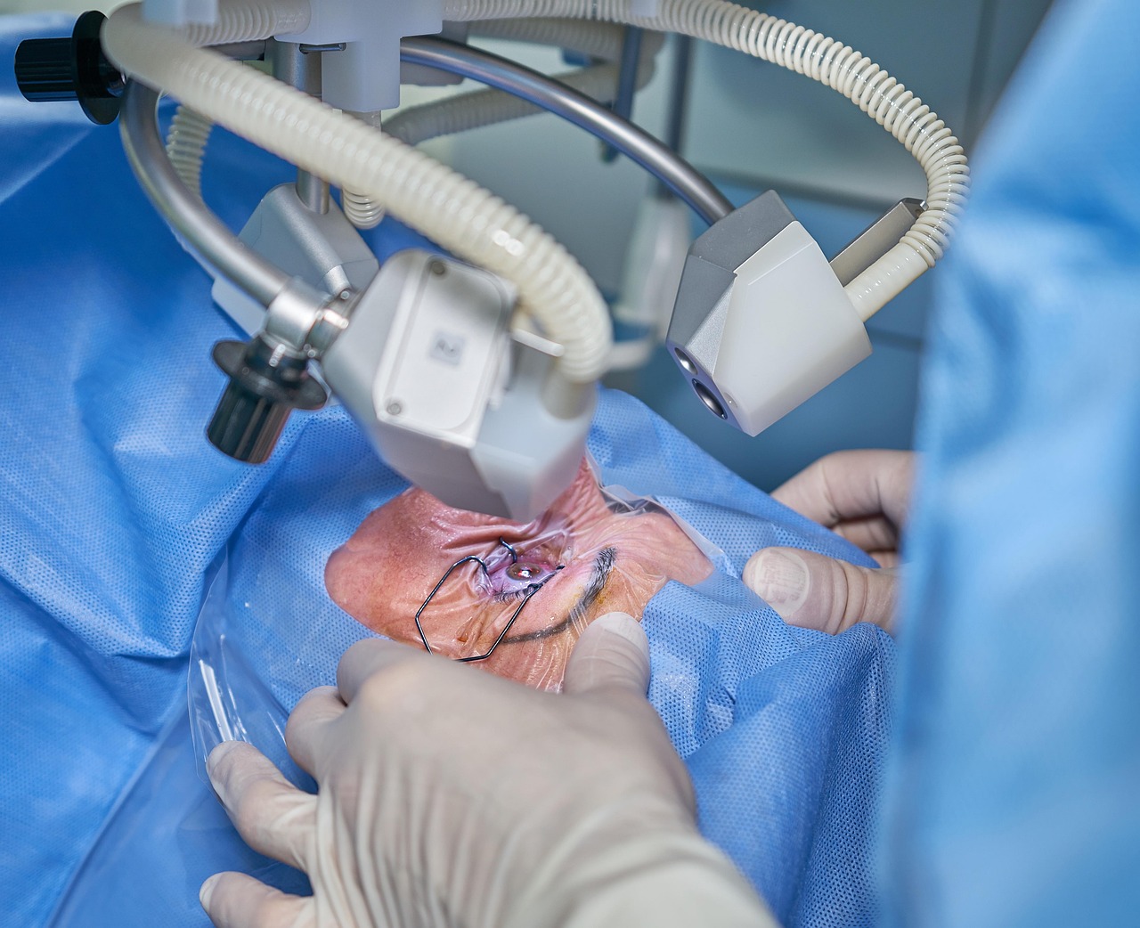 LASIK Surgeon
